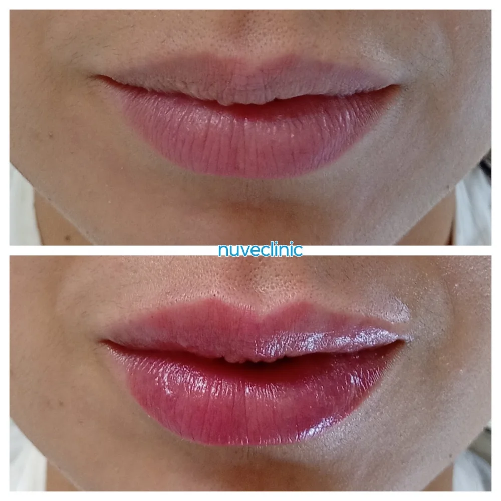 Nuveclinic - 2
